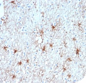 Formalin-fixed, paraffin-embedded human cerebellum stained with GFAP Mouse Monoclonal Antibody (GFAP/6879). HIER: Tris/EDTA, pH9.0, 45min. 2°C: HRP-polymer, 30min. DAB, 5min.