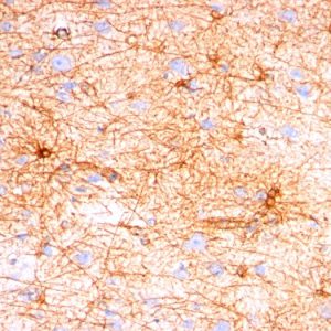 Formalin-fixed, paraffin-embedded human Cerebellum stained with GFAP Monoclonal Antibody (SPM507).