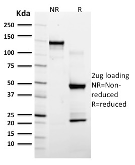 SDS-PAGE Analysis of Purified EGFR Mouse Monoclonal Antibody (GFR/2596). Confirmation of Integrity and Purity of Antibody.