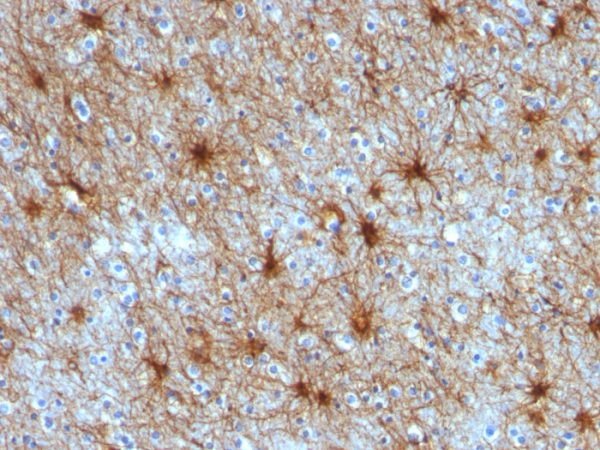 Formalin-fixed, paraffin-embedded human Cerebellum stained with GFAP Mouse Monoclonal Antibody (ASTRO/789).