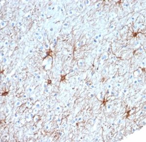 Formalin-fixed, paraffin-embedded human cerebral cortex stained with GFAP Mouse Monoclonal Antibody (GFAP/6880). HIER: Tris/EDTA, pH9.0, 45min. 2 °: HRP-polymer, 30min. DAB, 5min.