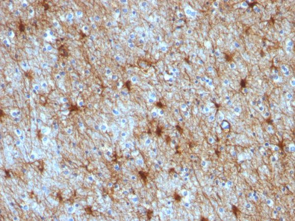Formalin-fixed, paraffin-embedded human Cerebellum stained with GFAP Monoclonal Antibody (GA-5 + ASTRO/789).