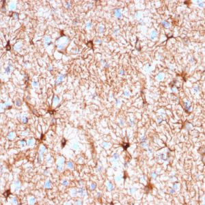 Formalin-fixed, paraffin-embedded human cerebellum stained with  GFAP Mouse Recombinant Monoclonal Antibody (rASTRO/789).