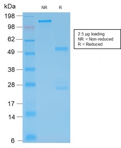 SDS-PAGE Analysis of Purified GFAP Mouse Recombinant Monoclonal Antibody (rASTRO/789). Confirmation of Integrity and Purity of Antibody.
