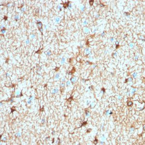 Formalin-fixed, paraffin-embedded human Cerebellum stained with GFAP Rabbit Recombinant Monoclonal Antibody (ASTRO/1974R).