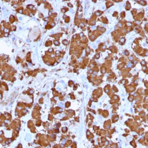 Formalin-fixed, paraffin-embedded human Pituitary stained with Growth Hormone Monoclonal Antibody (GH/1371).