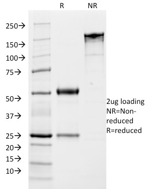 SDS-PAGE Analysis of Purified Growth Hormone Monoclonal Antibody (SPM106). Confirmation of Integrity and Purity of Antibody.