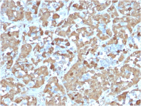 Formalin-fixed, paraffin-embedded human Pituitary stained with Growth Hormone Recombinant Mouse Monoclonal Antibody (rGH/1450).