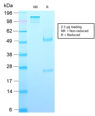 SDS-PAGE Analysis of Purified Growth Hormone Recombinant Mouse Monoclonal (rGH/1450). Confirmation of Integrity and Purity of Antibody.