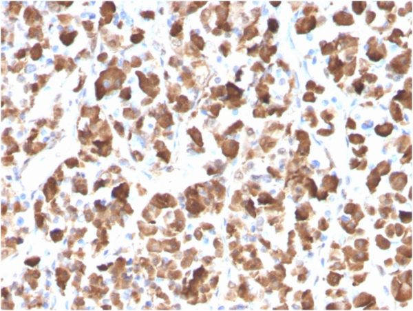 Formalin-fixed, paraffin-embedded human Pituitary stained with Growth Hormone Mouse Monoclonal Antibody (GH/3155).