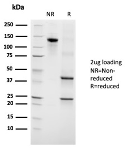 SDS-PAGE Analysis Purified Growth Hormone Mouse Monoclonal Antibody (GH/3155). Confirmation of Integrity and Purity of Antibody.