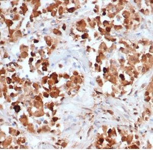 Formalin-fixed, paraffin-embedded human pituitary stained with Growth Hormone Recombinant Mouse Monoclonal Antibody (rGH/4887).