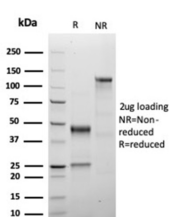 SDS-PAGE Analysis of Purified Growth Hormone Recombinant Rabbit Monoclonal Antibody (GH/4886R). Confirmation of Purity and Integrity of Antibody.