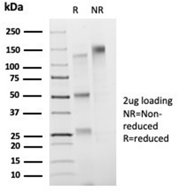 SDS-PAGE Analysis Purified FOXB1Mouse Monoclonal Antibody (PCRP-FOXB1-1B7). Confirmation of Purity and Integrity of Antibody.
