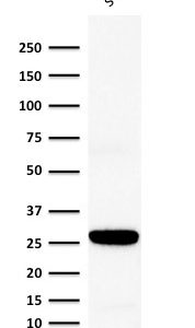 Western Blot Analysis of human stomach lysate using Connexin 32 Mouse Monoclonal Antibody (Clone M12.13)