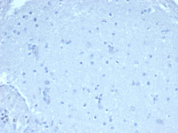IHC analysis of formalin-fixed, paraffin-embedded human brain. Negative tissue control. rFOXP1/6902 at 1ug/ml in PBS for 30min RT. HIER: Tris/EDTA, pH9.0, 45min. 2°C: HRP-polymer, 30min. DAB, 5min.