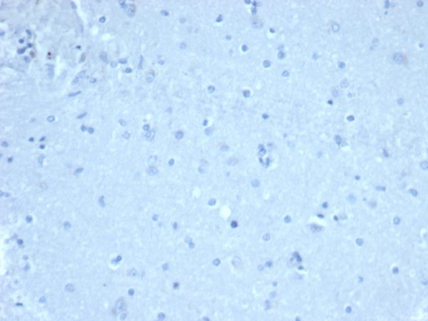 IHC analysis of formalin-fixed, paraffin-embedded human brain. Negative tissue control. FOXP1/44R at 1ug/ml in PBS for 30min RT. HIER: Tris/EDTA, pH9.0, 45min. 2°C: HRP-polymer, 30min. DAB, 5min.