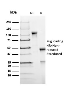 SDS-PAGE Analysis. Purified FOXP1 Recombinant Rabbit Monoclonal Antibody (FOXP1/44R). Confirmation of Integrity and Purity of Antibody.