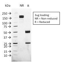 SDS-PAGE of Purified Glypican-3 Monoclonal Antibody (1G12). Confirmation of Integrity and Purity of Antibody.