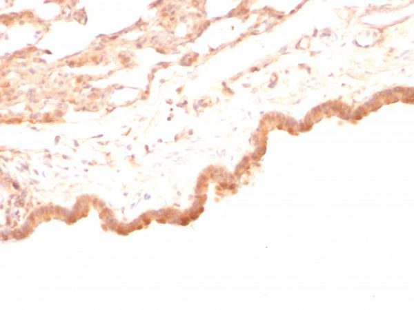 Formalin-fixed, paraffin-embedded Rat Lung stained with Glypican-3 Mouse Monoclonal Antibody (GPC3/863)