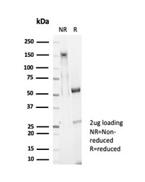 SDS-PAGE Analysis of Purified Glypican-3 Mouse Monoclonal Antibody (GPC3/7107). Confirmation of Integrity and Purity of Antibody.
