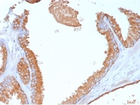 Formalin-fixed, paraffin-embedded human prostate stained with Glypican-3 Mouse Monoclonal Antibody (GPC3/7107). HIER: Tris/EDTA, pH9.0, 45min. 2°C: HRP-polymer, 30min. DAB, 5min.