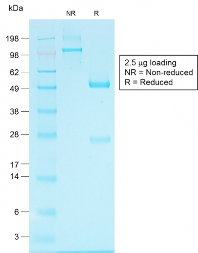 SDS-PAGE Analysis of Purified Glypican-3 Rabbit Recombinant Monoclonal Antibody (GPC3/1534R).