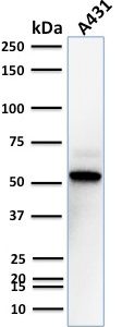 Western Blot Analysis of A431 cell lysate using TOX3 Mouse Monoclonal Antibody (TOX3/1123).