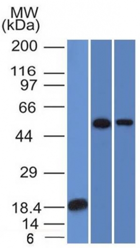 Western Blot Analysis (A) Recombinant protein (B) A549 (C) A431 TOX3 Mouse Monoclonal Antibody (TOX3/1124).