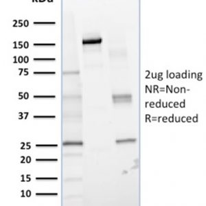 SDS-PAGE Analysis of Purified Glyoxalase 1 (GLO1) Mouse Monoclonal Antibody (CPTC-GLO1-1). Confirmation of Integrity and Purity of Antibody.