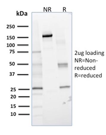 SDS-PAGE Analysis of Purified Glyoxalase 1 (GLO1) Mouse Monoclonal Antibody (CPTC-GLO1-1). Confirmation of Integrity and Purity of Antibody. Glyoxalase 1 (GLO1) Antibody