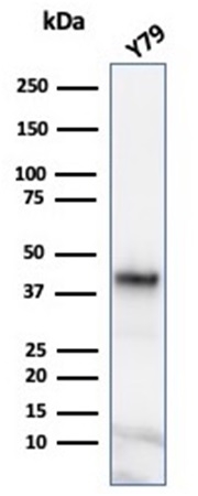 Western blot analysis of Y79 cell lysate using Glutamine Synthetase Mouse Monoclonal Antibody (GLUL/6600).