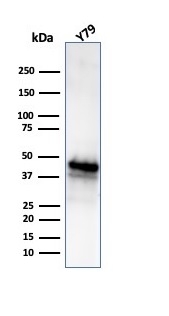 Western blot analysis of Y79 cell lysate using Glutamine Synthetase Mouse Monoclonal Antibody (GLUL/6604).