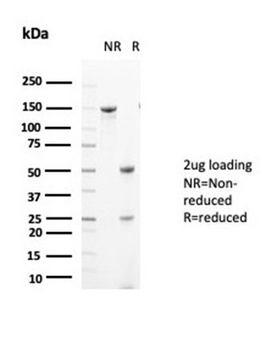 SDS-PAGE Analysis of Purified Glutamine Synthetase Mouse Monoclonal Antibody (GLUL/6604). Confirmation of Purity and Integrity of Antibody.