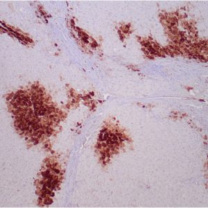 Formalin-fixed, paraffin-embedded human liverstained with Glutamine Synthetase MouseMonoclonal Antibody (GLUL/6599) at 2ug/ml.