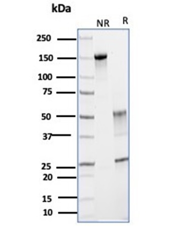 SDS-PAGE Analysis Purified Glutamine Synthetase Mouse Monoclonal Antibody (GLUL/6599). Confirmation of Purity and Integrity of Antibody.