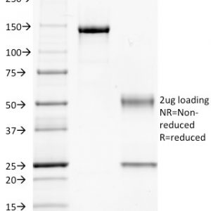 SDS-PAGE Analysis of Purified GNAQ Mouse Monoclonal Antibody (GNAQ/2434). Confirmation of Integrity and Purity of the Antibody.
