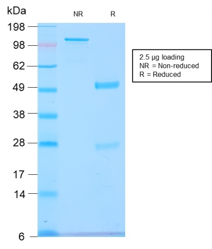 SDS-PAGE Analysis of Purified GnRH-R Rabbit Recombinant Monoclonal Antibody (GNRHR/2982R). Confirmation of Purity and Integrity of Antibody.
