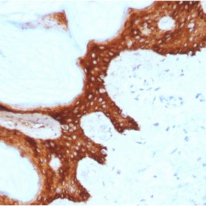 Formalin-fixed, paraffin-embedded human Skin stained with Stratifin Mouse Monoclonal Antibody (CPTC-SFN-2).