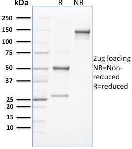 SDS-PAGE Analysis of Purified CLEC9A Mouse Monoclonal Antibody (8F9). Confirmation of Integrity and Purity of Antibody.