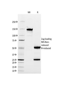 SDS-PAGE Analysis of Purified CD13 Mouse Monoclonal Antibody (WM15). Confirmation of Integrity and Purity of Antibody.
