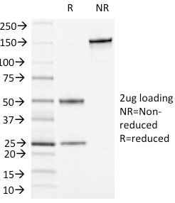SDS-PAGE Analysis of Purified CD13 Mouse Monoclonal Antibody (APN/1464). Confirmation of Integrity and Purity of Antibody.