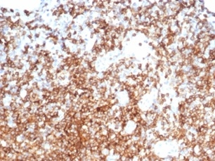 Formalin-fixed, paraffin-embedded human tonsil stained with CD13 Mouse Monoclonal Antibody (APN/6998). HIER: Tris/EDTA, pH9.0, 45min. 2 °: HRP-polymer, 30min. DAB, 5min.