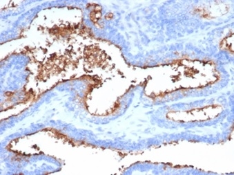 Formalin-fixed, paraffin-embedded human prostate stained with CD13 Mouse Monoclonal Antibody (APN/6998). Inset: PBS instead of primary antibody; secondary only negative control.