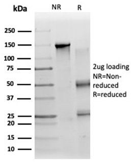 SDS-PAGE Analysis of Purified ZC3H7A Mouse Monoclonal Antibody (PCRP-ZC3H7A-1D6). Confirmation of Purity and Integrity of Antibody.