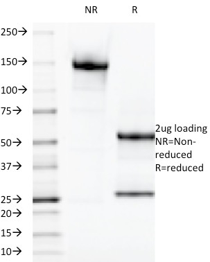 SDS-PAGE Analysis of Purified Galectin-13 / PP13 Monoclonal Antibody (PP13/1165) Confirmation of Purity and Integrity of Antibody.