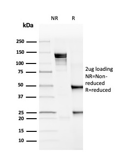 SDS-PAGE Analysis of Purified PD-L1 Recombinant Mouse Monoclonal Antibody (rPDL1/4772).Confirmation of Purity and Integrity of Antibody.