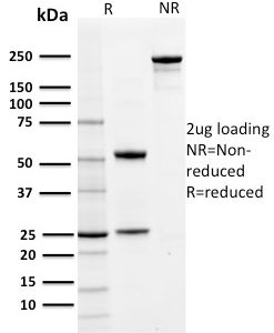 SDS-PAGE Analysis of Purified PD-L1 Mouse Monoclonal Antibody (PDL1/2742). Confirmation of Purity and Integrity of Antibody.