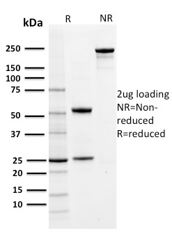 SDS-PAGE Analysis of Purified PD-L1 Mouse Monoclonal Antibody (PDL1/2742). Confirmation of Purity and Integrity of Antibody.