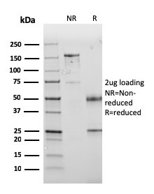 SDS-PAGE Analysis of Purified PD-L1 Mouse Monoclonal Antibody (PDL1/2745). Confirmation of Purity and Integrity of Antibody.